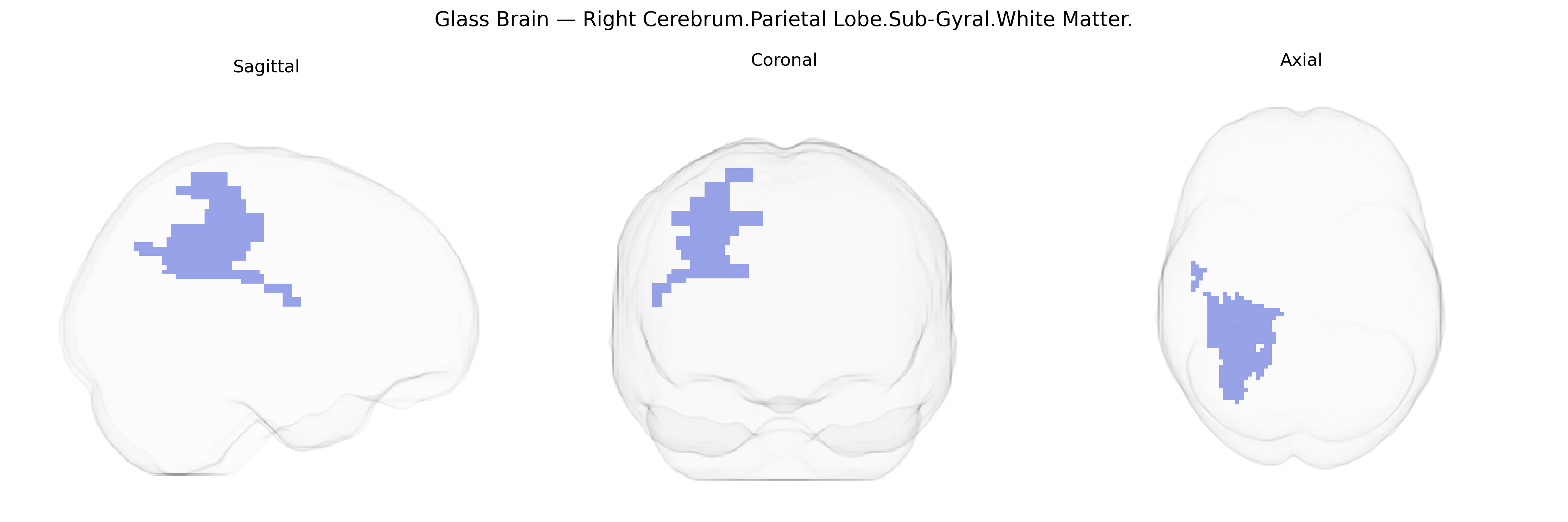 Triplanar Ghost Brain