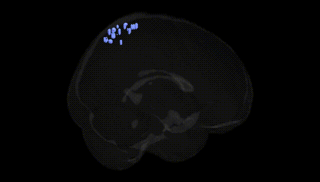 Full Brain Black