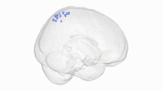 Full Brain White