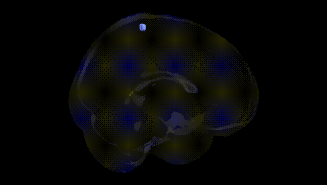 Full Brain Black