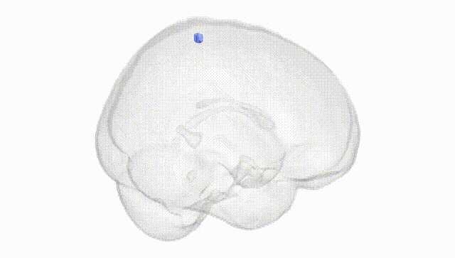 Full Brain White