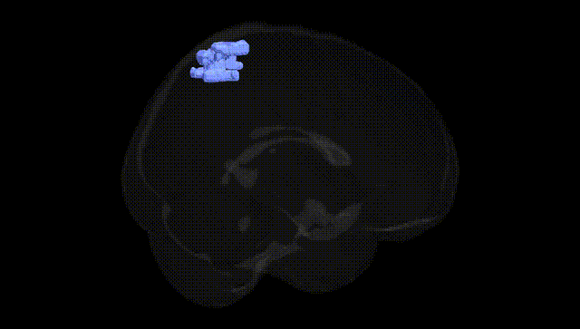 Full Brain Black