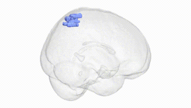 Full Brain White