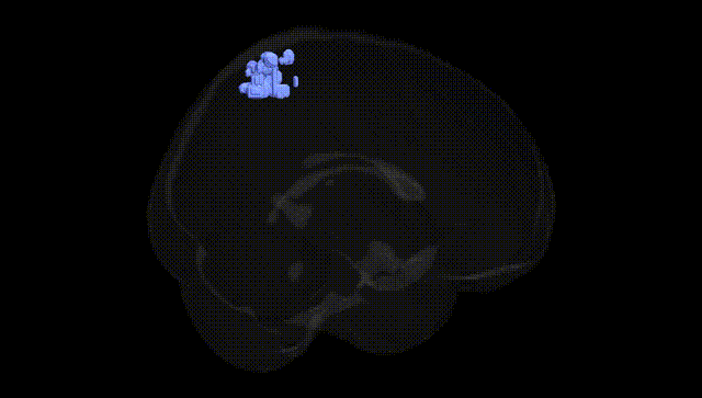 Full Brain Black