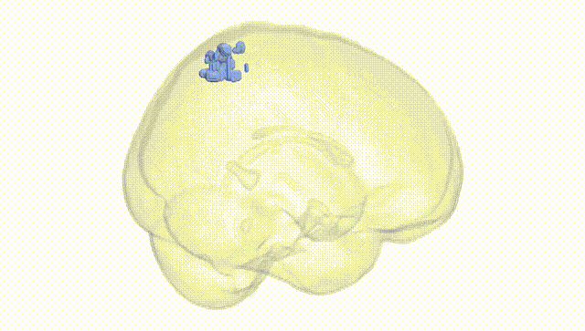 Full Brain White