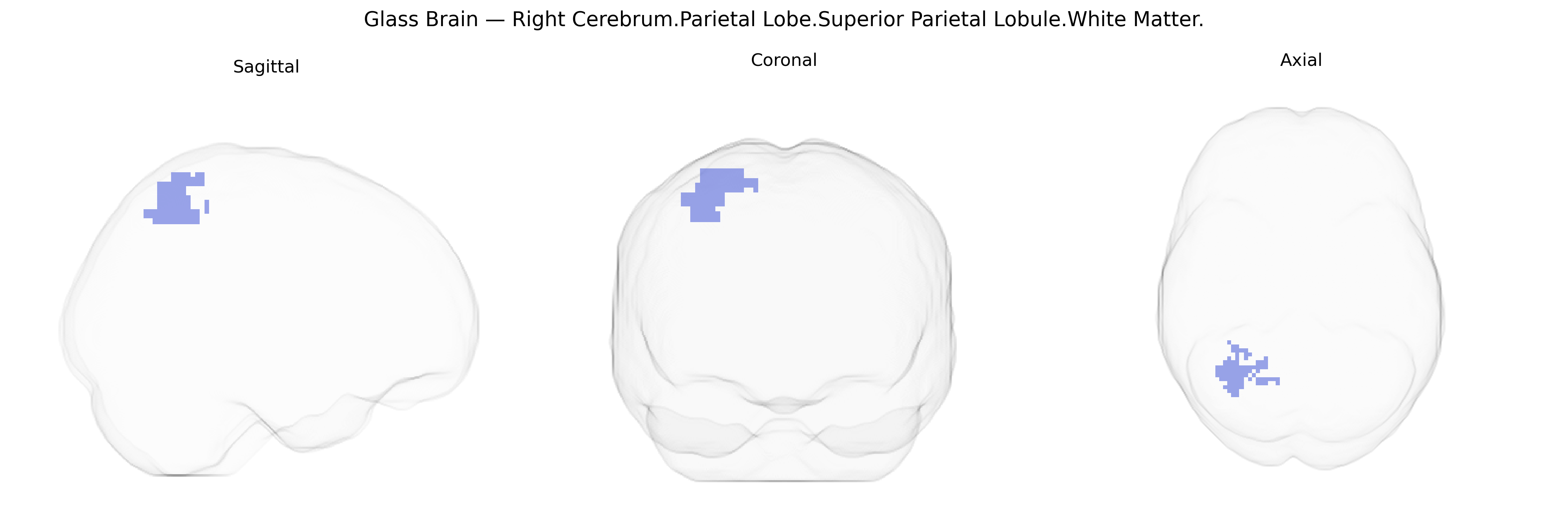 Triplanar Ghost Brain