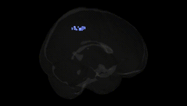 Full Brain Black