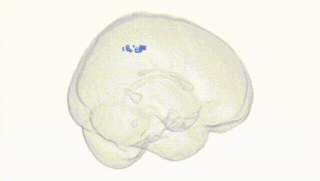 Full Brain White