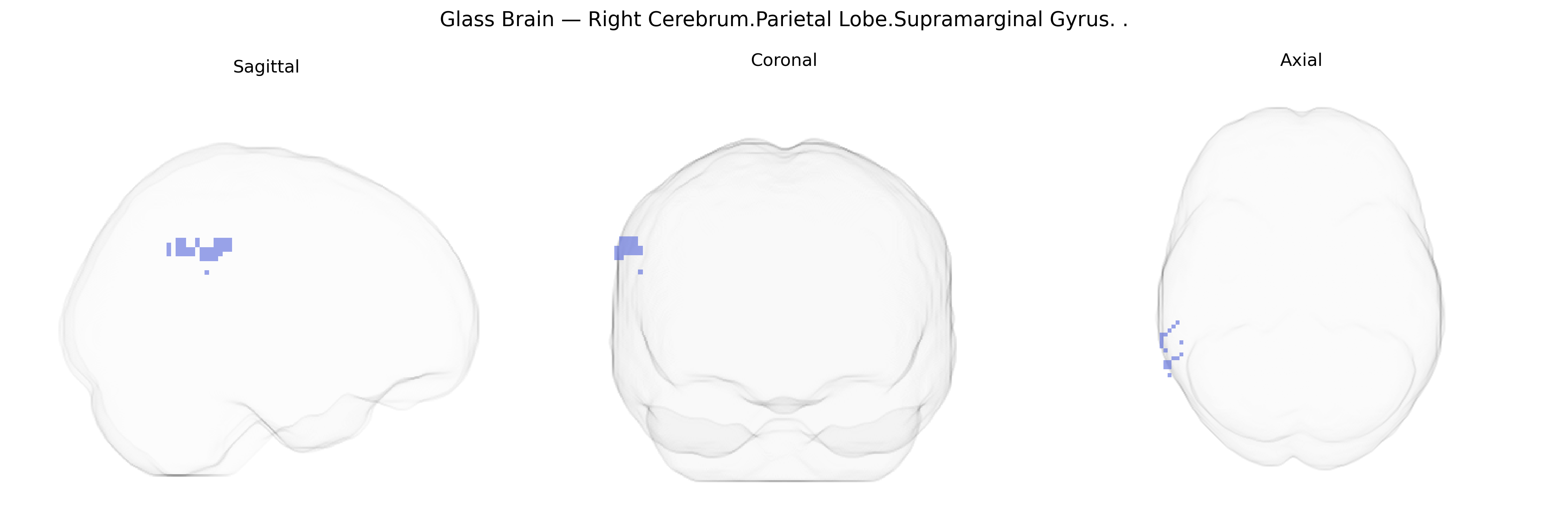Triplanar Ghost Brain