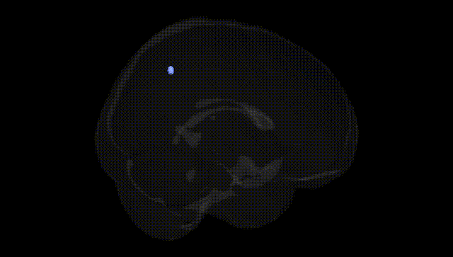 Full Brain Black