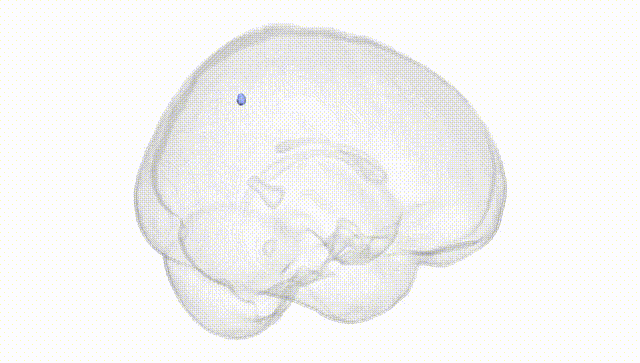 Full Brain White