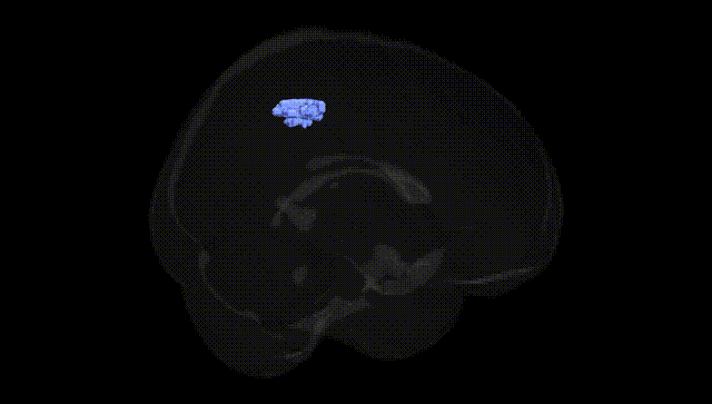 Full Brain Black