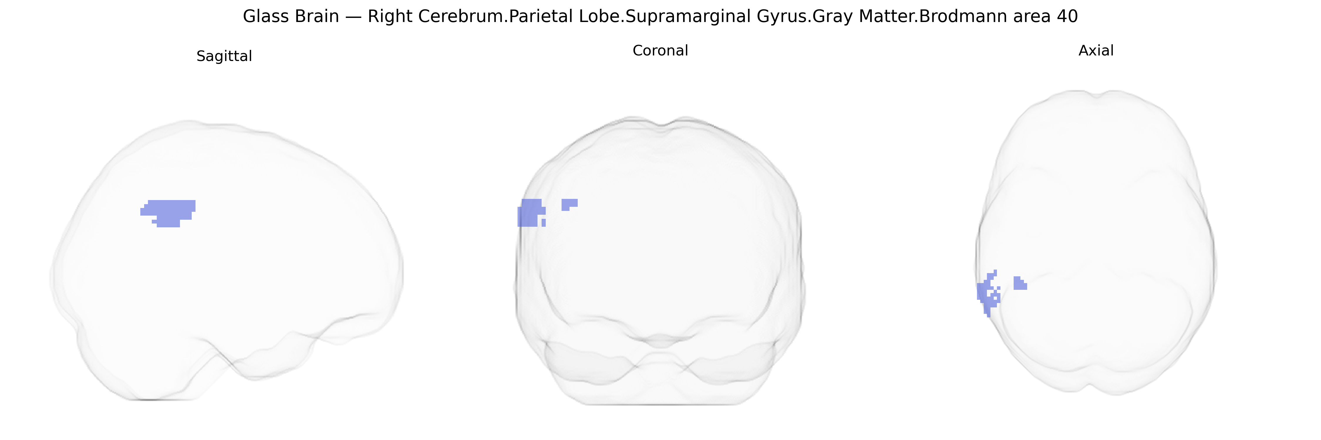 Triplanar Ghost Brain