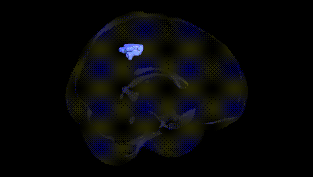 Full Brain Black