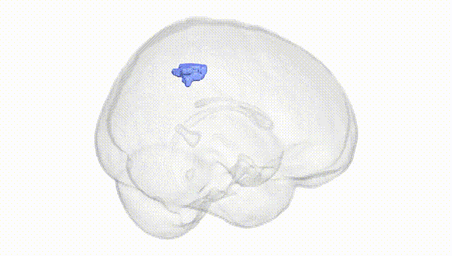Full Brain White