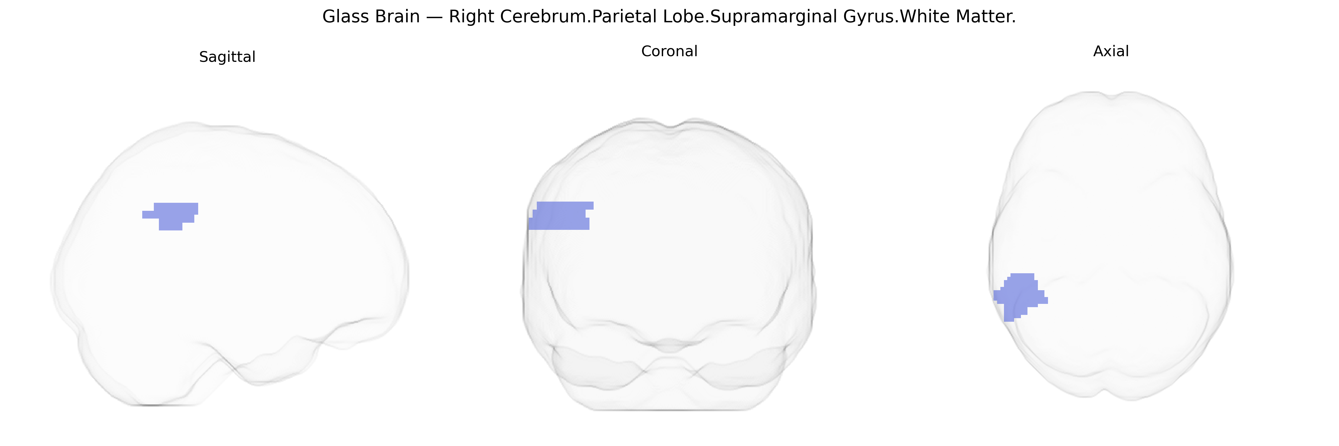 Triplanar Ghost Brain