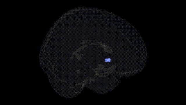Full Brain Black