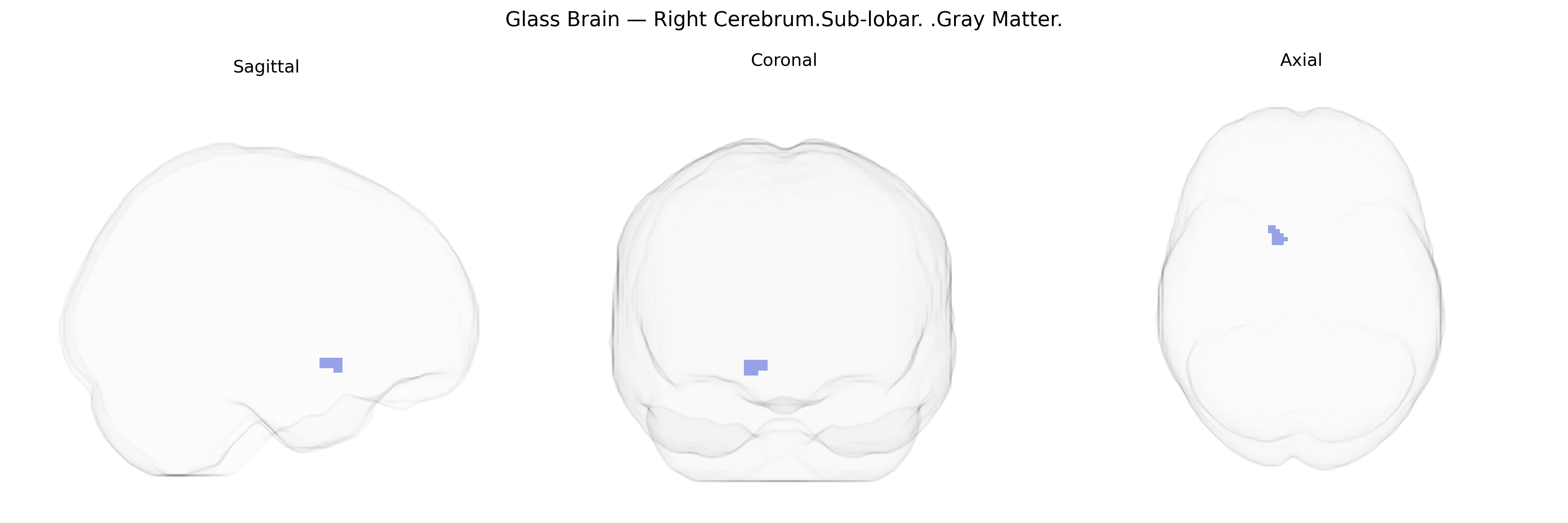 Triplanar Ghost Brain