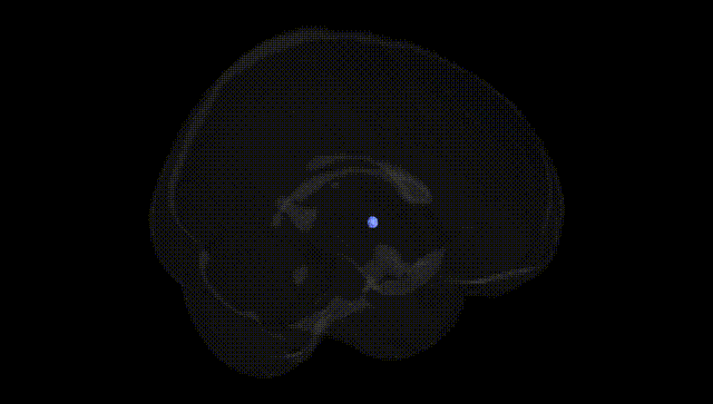 Full Brain Black