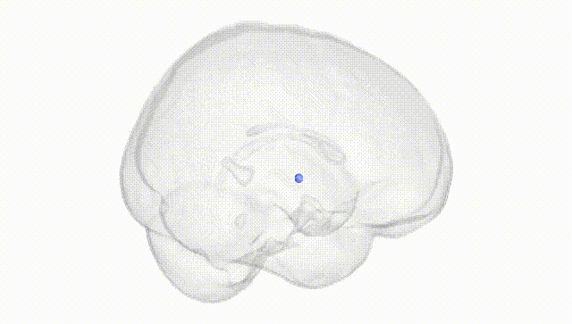 Full Brain White