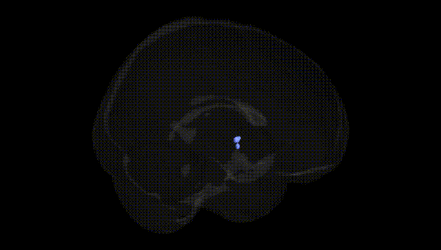 Full Brain Black