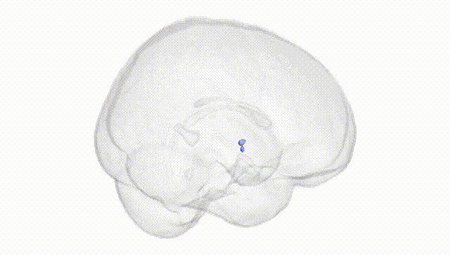 Full Brain White