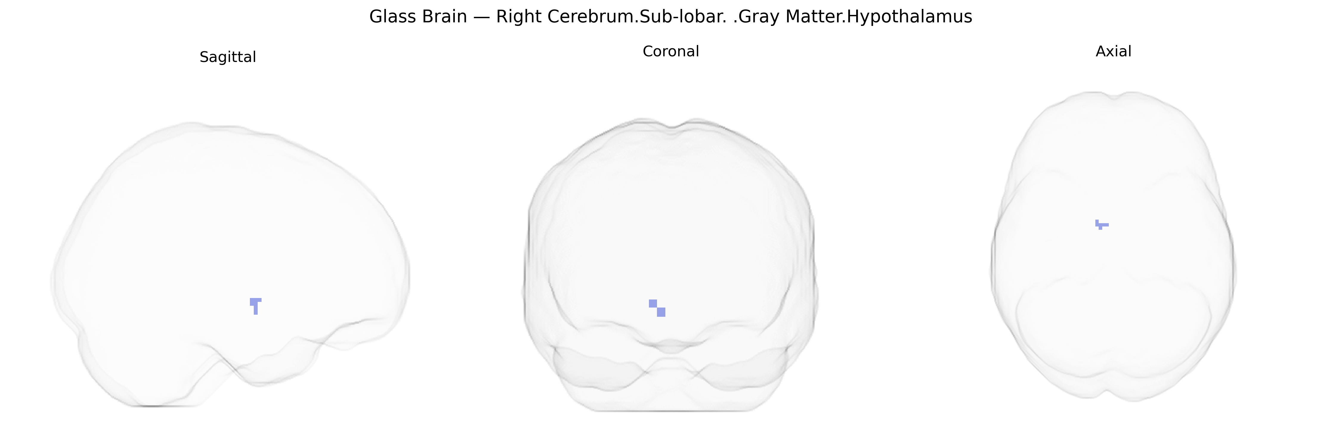 Triplanar Ghost Brain