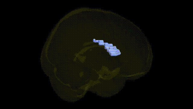 Full Brain Black