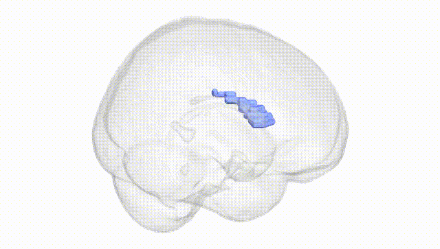 Full Brain White
