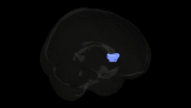 Full Brain Black