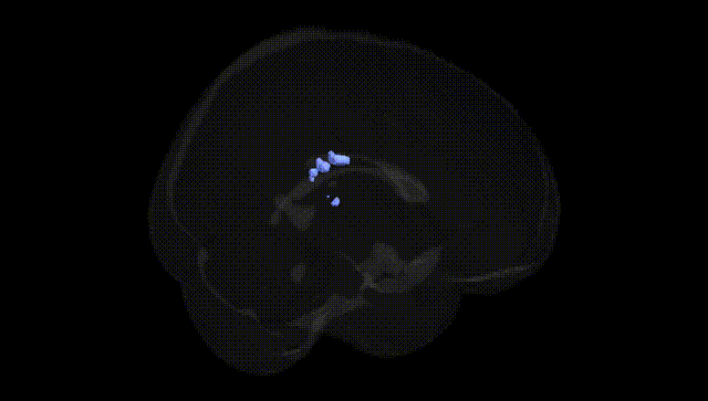 Full Brain Black