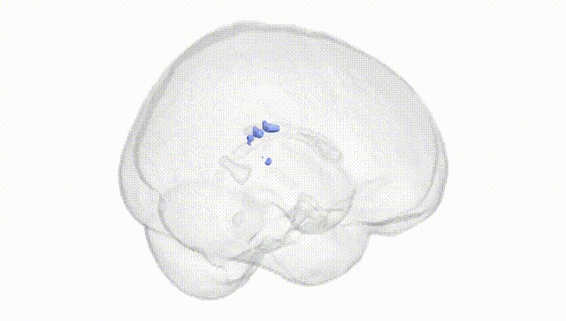 Full Brain White