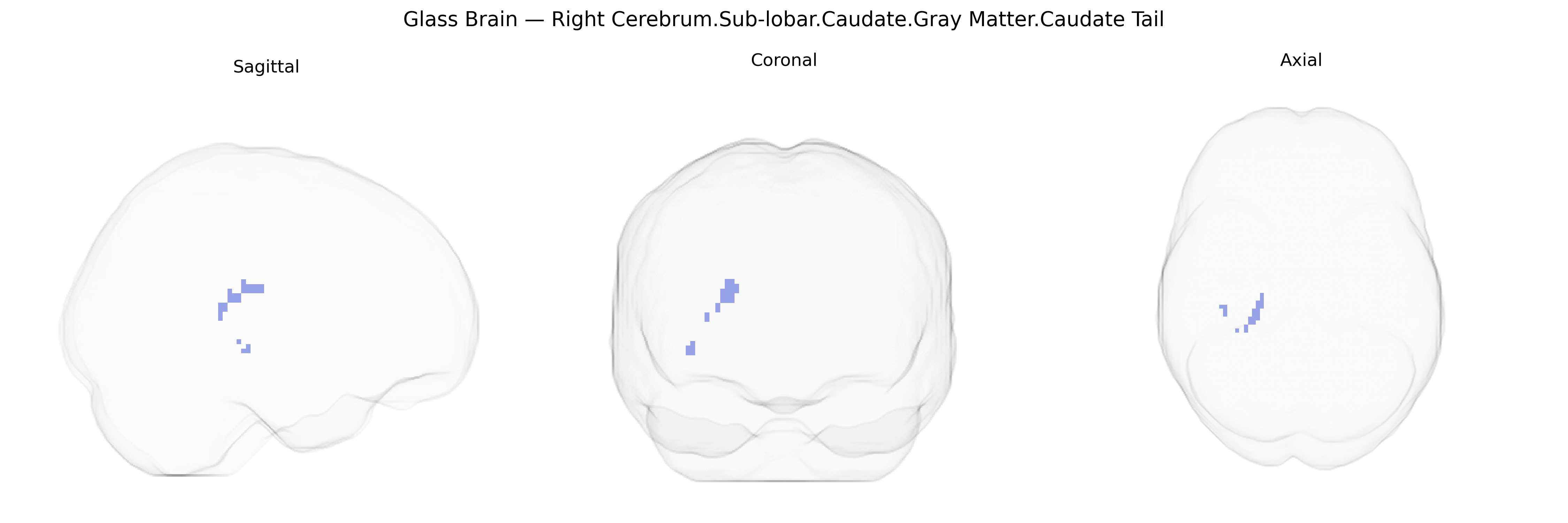 Triplanar Ghost Brain