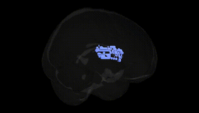 Full Brain Black