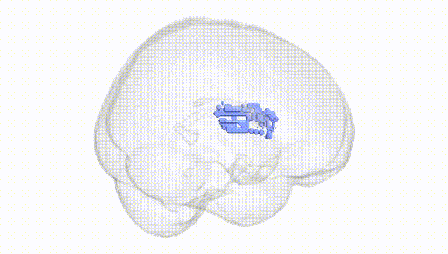 Full Brain White
