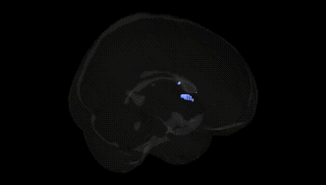 Full Brain Black
