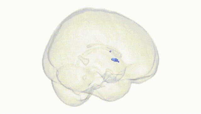 Full Brain White