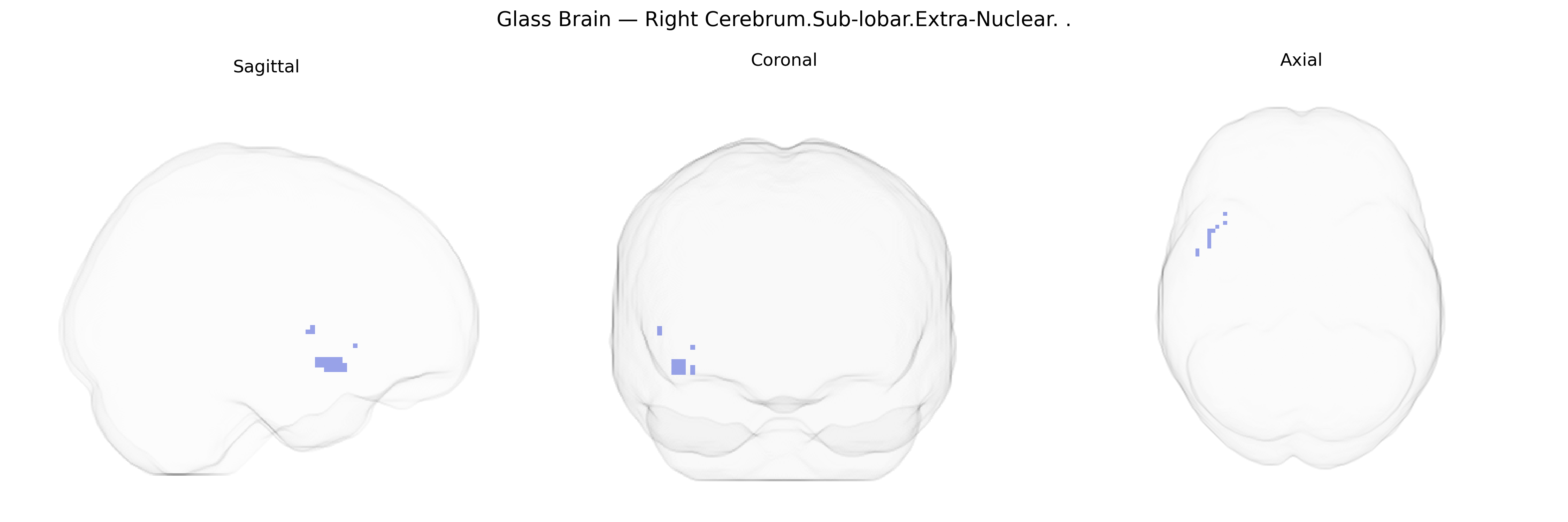 Triplanar Ghost Brain