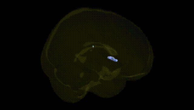 Full Brain Black