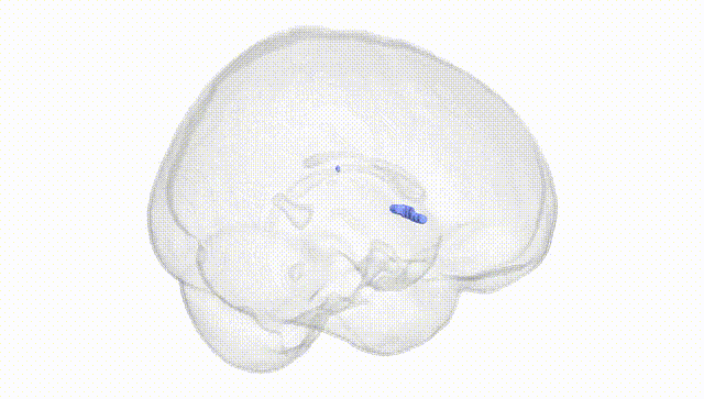 Full Brain White