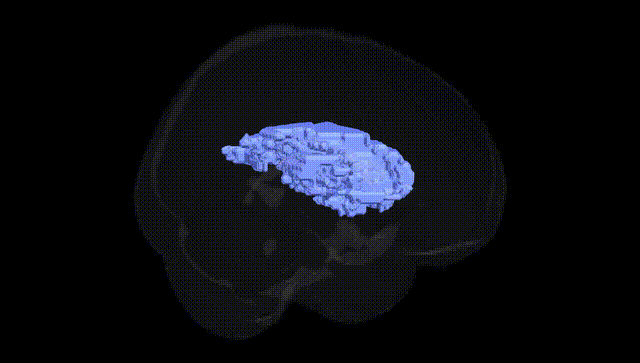 Full Brain Black