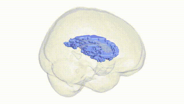 Full Brain White