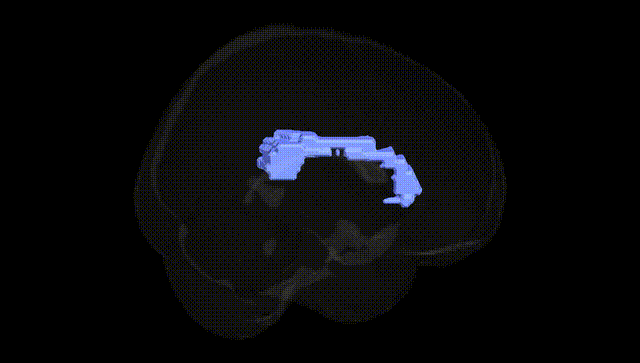 Full Brain Black
