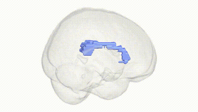 Full Brain White