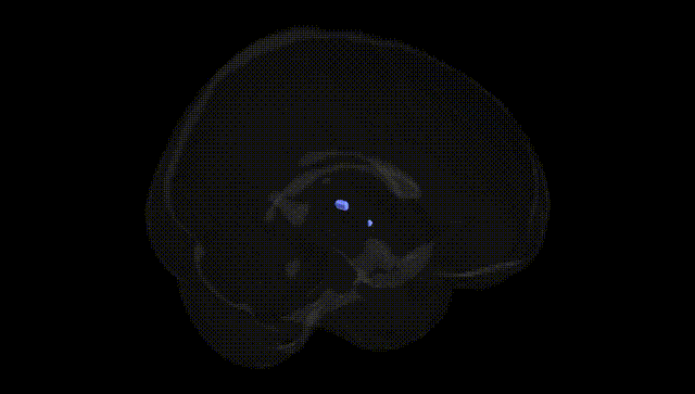 Full Brain Black