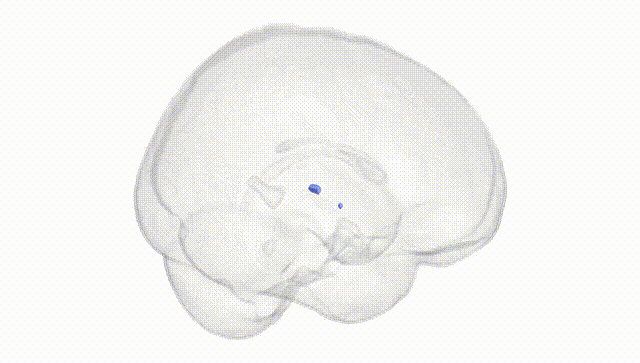 Full Brain White