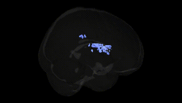 Full Brain Black