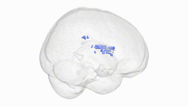 Full Brain White
