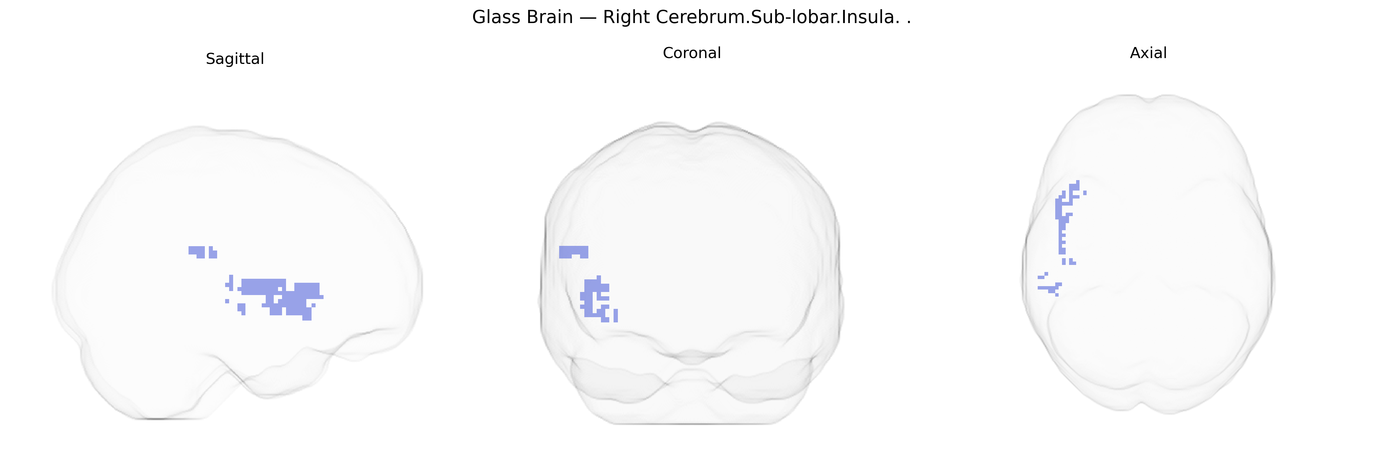 Triplanar Ghost Brain
