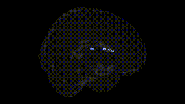 Full Brain Black